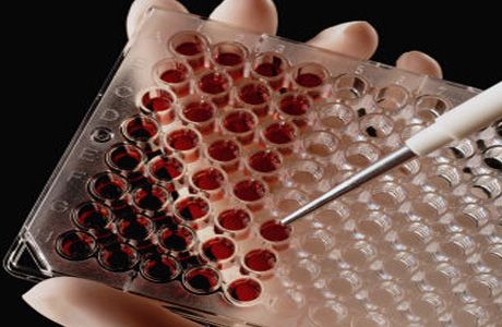 Heterosexuelle Übertragung von HIV: neue Erkenntnisse