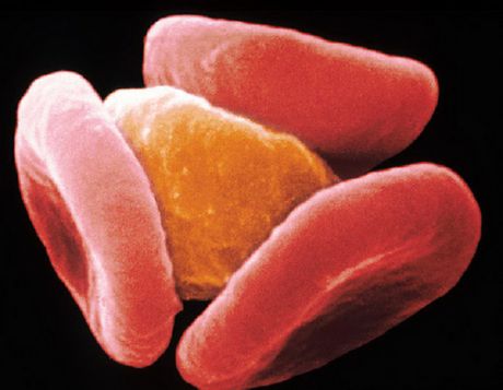 Malariaparasit lässt das Immunsystem seine Existenz vergessen