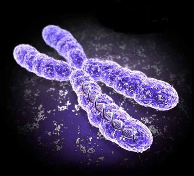 Die Ursache der Migräne ist eine Mutation des X-Chromosoms