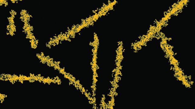 Prionen – die Erreger von Prionenerkrankungen