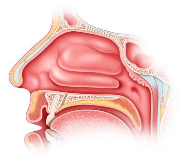 Vasomotorische Rhinitis