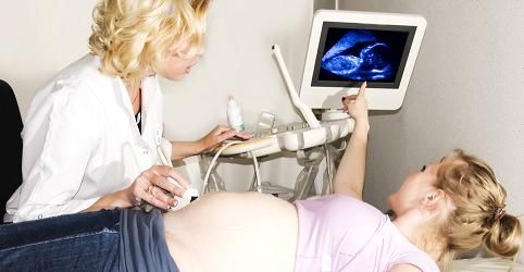 Frauen entscheiden sich zunehmend für Kaiserschnitt